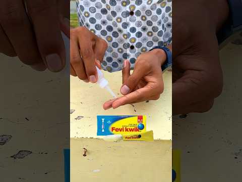 How to remove feviquick from hand? #shorts