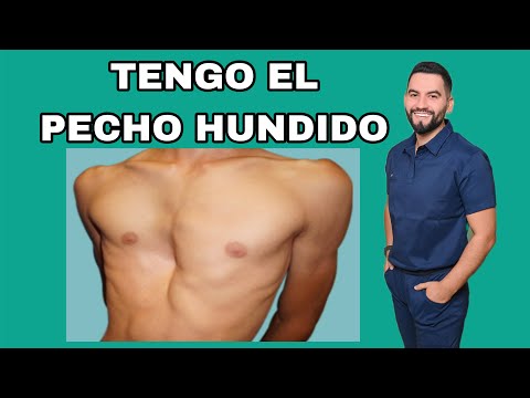 TENGO EL PECHO HUNDIDO / PECTUS EXCAVATUN | DR. DAVID CAMPOS