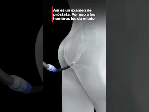 Así es un examen de próstata. Por eso a los hombres les da miedo.
