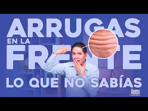 ARRUGAS EN LA FRENTE. LO QUE NO SABÍAS