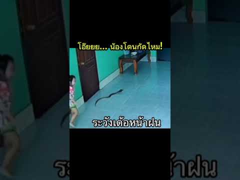 น้องโดนกัดไหม