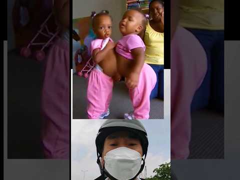 Twin baby #video #conma #trending #tiktok
