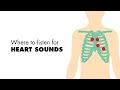 Heart Sounds and Auscultation Techniques