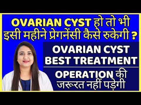 OVARIAN CYST हो तो भी 1 महीने में प्रेगनेंसी कैसे रुकेगी | OVARIAN CYST BEST TREATMENT