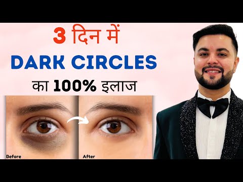 3 दिन में Dark Circles का 100% इलाज: 3 Days Clear Skin Challenge