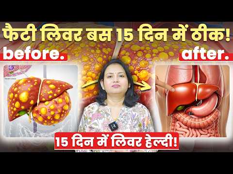 फैटी लिवर की सफाई के 7 घरेलू उपाय – सिर्फ 15 दिन में असर