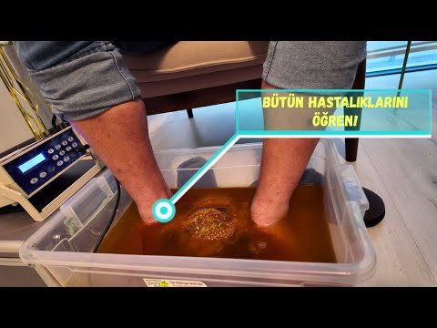 Vücut Temizliğimin Şok Edici Anı! Detoks Makinesinde Gördüğüm Kirli Sır! Vücudunun Zehirini At!