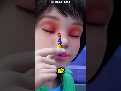 26 Yıl Burnunda Oyuncakla Yaşadı! 😱