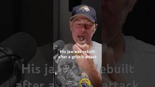 His jaw was rebuilt after a grizzly attack￼