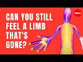 Phantom Limb Sensations and Pain