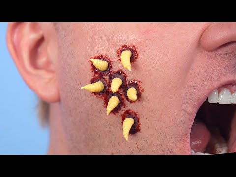 MAGGOTS CRAWL OUT FACE!