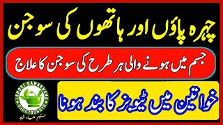 Face ,Hands And Feet Swelling Treatment | Treatment of Block Tubes | Hath Paon ki sojan ka ilaj