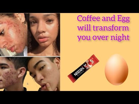 how you can use coffee And Egg to remove Acne, wrinkles and hyper pigmentation || Skin care