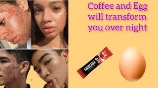 how you can use coffee And Egg to remove Acne, wrinkles and hyper pigmentation || Skin care