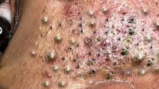 حلول طبيعية لبشرة صافية#𝐋𝐍𝐆