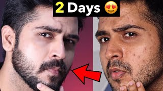 Natural Way To Get Glass Skin | Glowing Skin At Home | Remove Pimples and Dark Spots