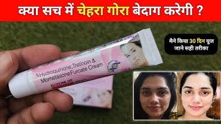 Elosan ht cream review | elosan ht cream use kaise kare | elosan ht cream 