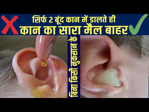 सिर्फ 2 बूंद कान में डालते ही कान का सारा मैल बाहर, बिना किसी नुकसान के