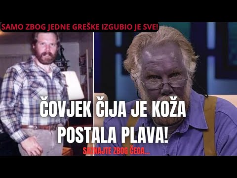Čovjek je postao potpuno plav kada je popio ovo!