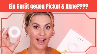 Funktioniert das wirklich? Was kann der neue Ziip Dot?