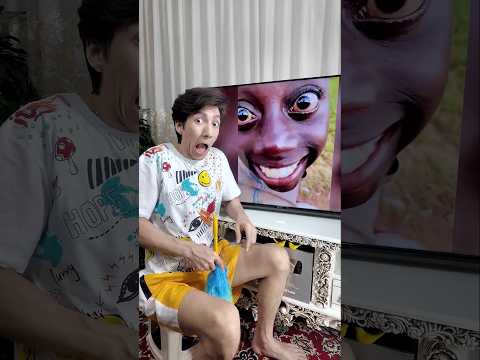 Frog-Eyed Boy’s Epic Fail 😂 #toshleh #funny #fail