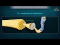 Nerve Injury Classification and Prognosis