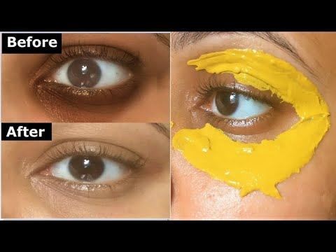 خلال 15 دقيقة فقط تخلصي من الهالات السوداء وانتفاخ و ترهل الجفون وكل التجاعيد حول العين ستختفي