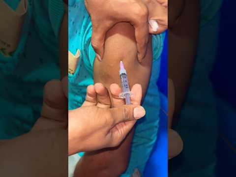 Titanus intramuscular injection 💉😱1245#doctor #trendingshorts #viralshorts