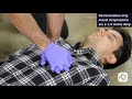 CPR Techniques and Procedures