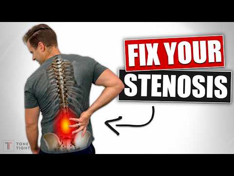 Fix Lower Back Stenosis And Sciatica! [Home Exercises For DDD And Arthritis]