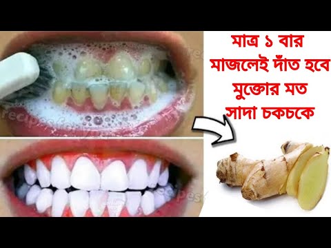 ম্যাজিকের মতো দাঁত  সাদা হবে এই ঘরোয়া উপায়ে/ দাঁতের কালো দাগ,আয়রন সব তুলে দেবে/Teeth Whitening