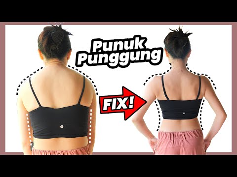 Cara Menghilangkan Punuk Punggung
