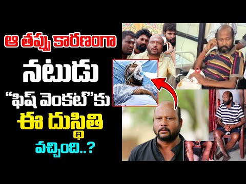 ఆ తప్పు కారణంగా నటుడు "ఫిష్ వెంకట్"కు ఈ దుస్థితి వచ్చింది..? | Actor Fish Venkat Health Update's