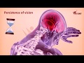 Understanding Persistence of Vision