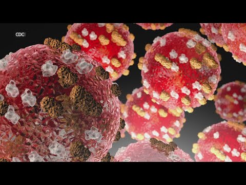 YouTube video thumbnail: New Mexico Measles Cases Now at 100, According to Health Department