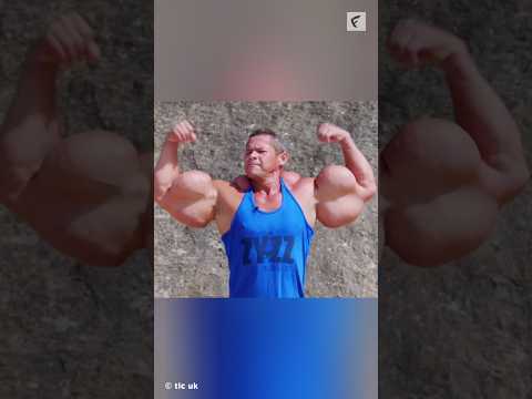 How Synthol Creates Fake Muscles