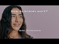 Understanding Braces and Teeth Movement