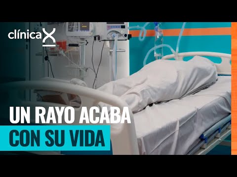Jóvenes sufren serias heridas tras ser alcanzados por un rayo | Clínica X