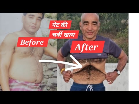 Pet Kam Karne ki Best exercise - Before 95kg After 64kg