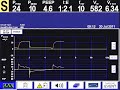 Understanding the Video Tutorial