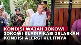Wajah Memerah dan Membengkak, Jokowi: Saya Baik-baik Saja | OneNews Update