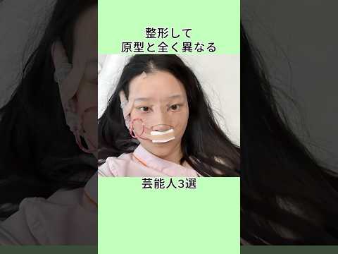 整形して原型と全く異なる芸能人3選  #shorts