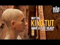 Artificial Head Binding in Ancient Egypt