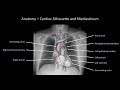 Systematic Approach to Chest X-ray Interpretation