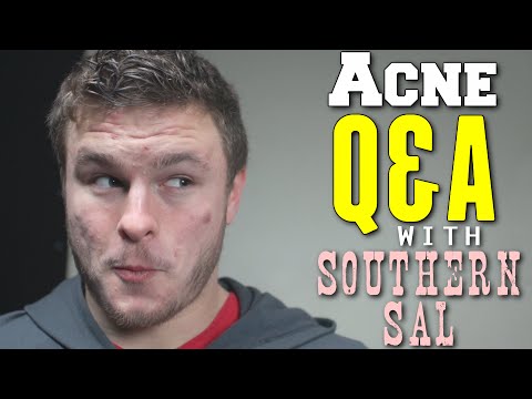 Week 57 - Acne Q&A w/Southern Sal (Blackheads, Pictures & More)
