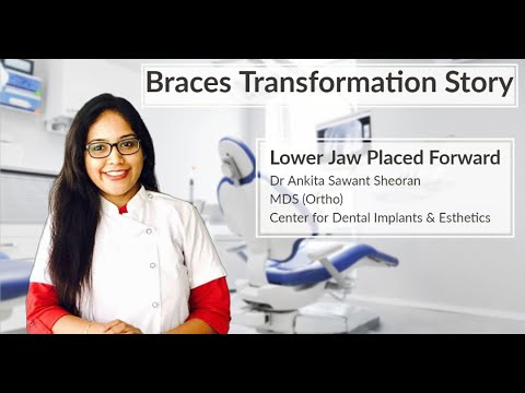 Patient Transformation