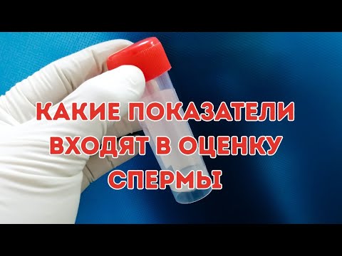 По каким параметрам оценивают сперму #доказательнаямедицина #бесплодие #doctorberezovska