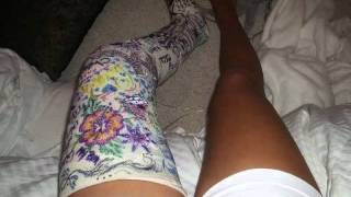 My Long Leg Cast For My Broken Knee Cap