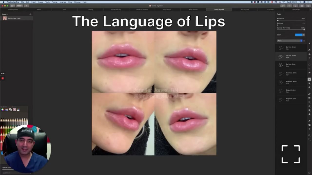 Close-ups of glossy, full lips in various angles.