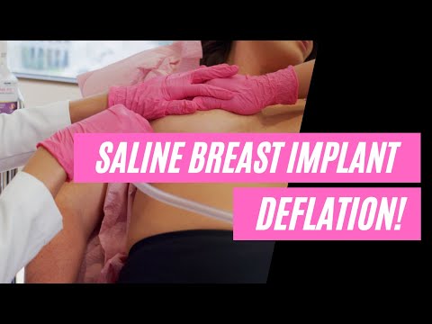 Saline Breast Implant Deflation